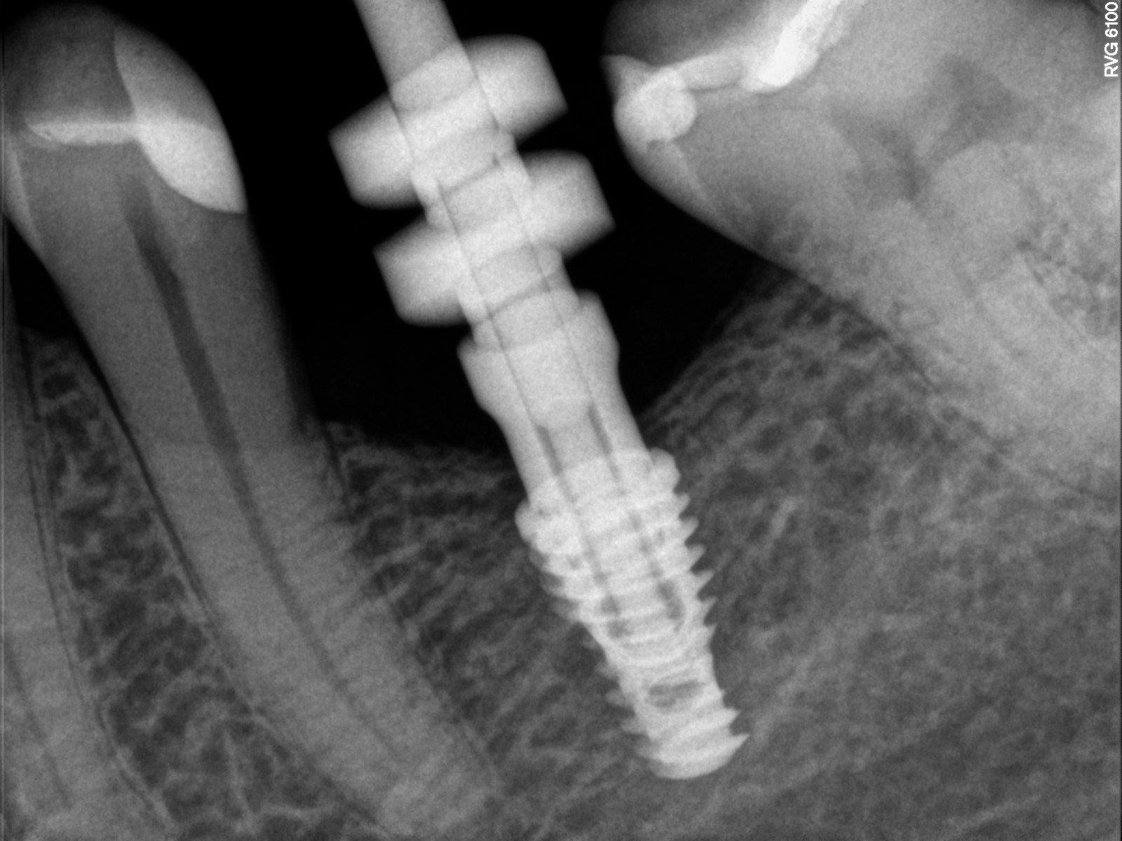Chirurgia Stomatologiczna Gdynia